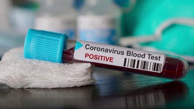 State-Wise Break Up Of Coronavirus Cases And Death